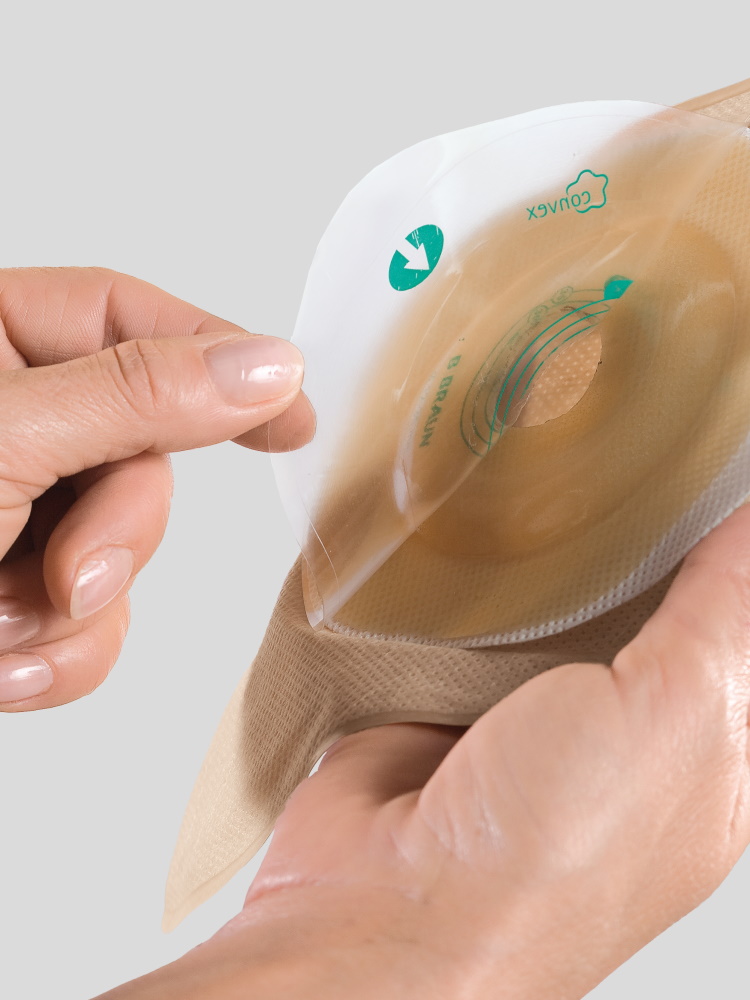 A stoma bag with a convex-shaped wafer